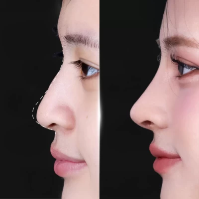 Những yếu tố ảnh hưởng đến kết quả thẩm mỹ mà ít người để ý