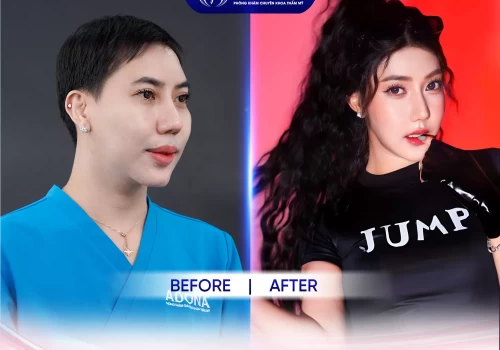 Hot Tiktoker Huỳnh My