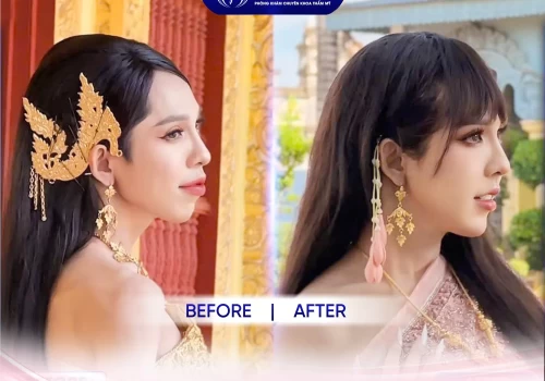 Hot Tiktoker Thành Ý Võ