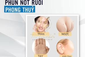 Phun nốt ruồi phong thuỷ