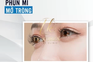 Phun mí mở tròng