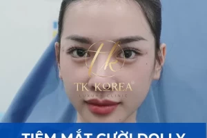 Tiêm mắt cười DOLLY