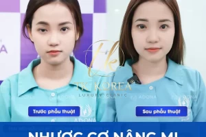 Nhược Cơ Nâng Mi
