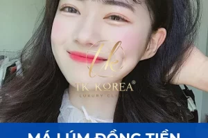 Má Lúm Đồng Tiền